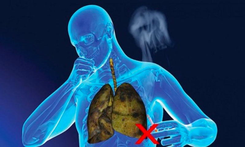 Khói thuốc lá cũng là một tác nhân gây bệnh nguy hiểm
